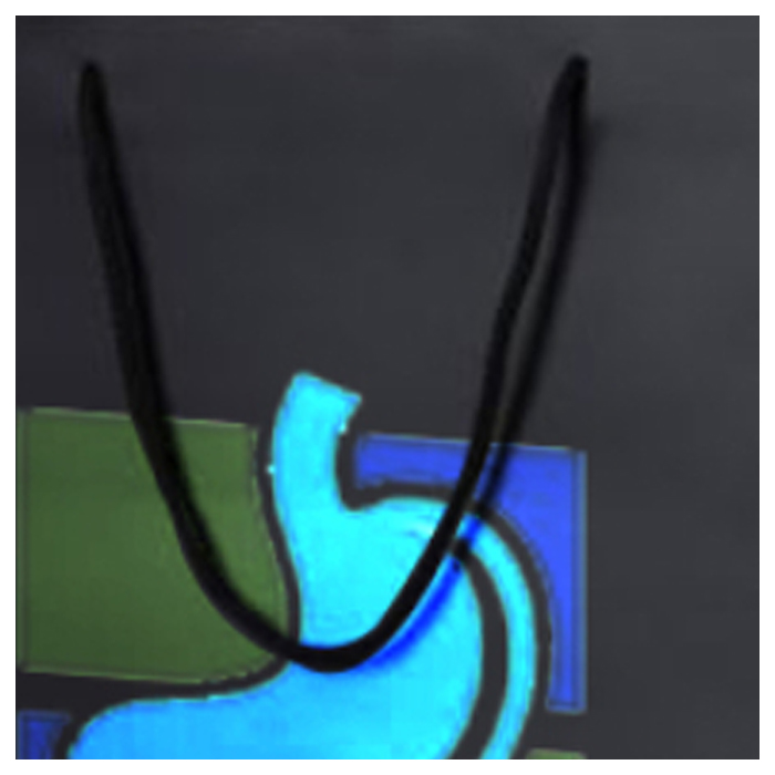 greenhandle
